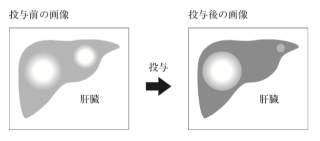 解説画像